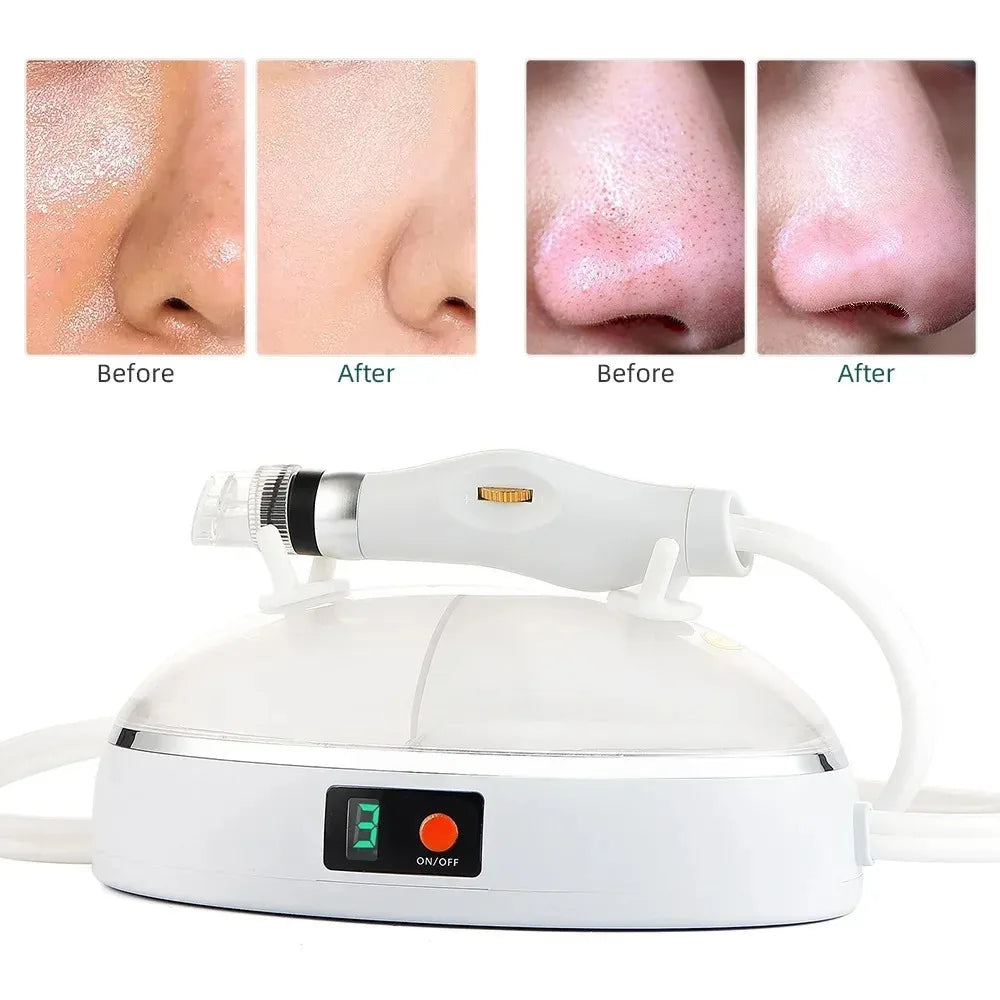 New Hydra Face Care Device for Skin Moisturizing Vacuum Cleaning Jet Small Bubbles Blackheads Remover Suction Tool Pore Cleaner