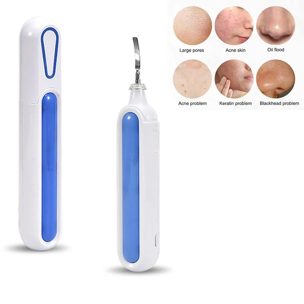 Portable Pore Cleansing Skin Scrubber Spatula Face Peeling Sonic Facial Ultrasonic Skin Scrubber Spatula Ultra Skin Scrubber